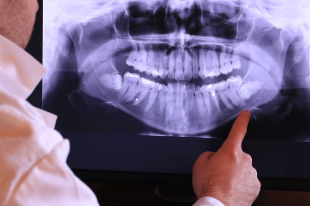 Best Emergency Dental Care for Broken or Chipped Teeth in Inverness, IL