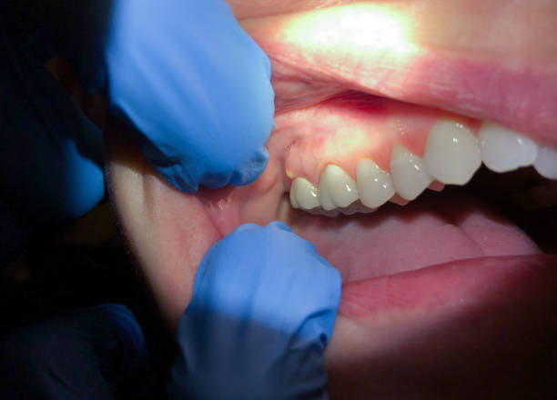 Best Emergency TMJ Treatment in Inverness, IL